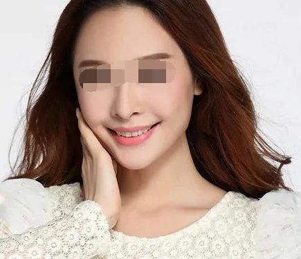 盘点有哪些的济南鼻翼突美容整形医院_附鼻翼突整形行情价格