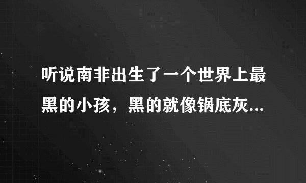听说南非出生了一个世界上最黑的小孩，黑的就像锅底灰一样，是真的吗？