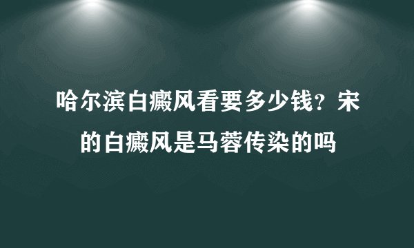 哈尔滨白癜风看要多少钱？宋喆的白癜风是马蓉传染的吗