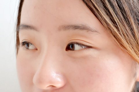 脸部过敏红肿怎么治