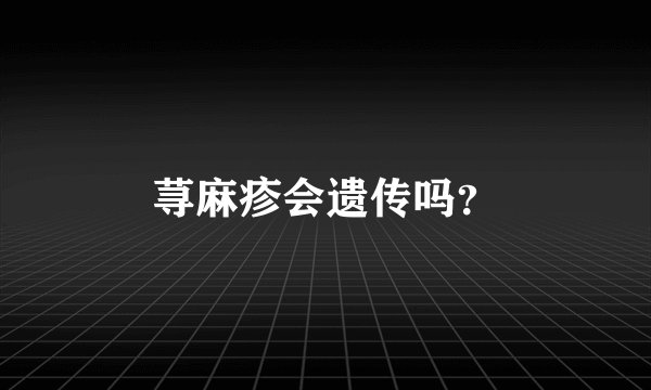 荨麻疹会遗传吗？