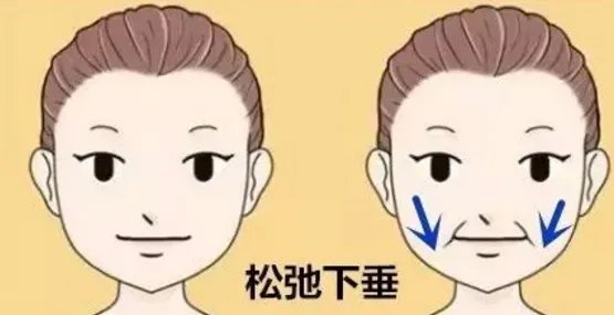 全脸脂肪填充几天消肿?究竟全脸脂肪填充多久可以恢复自然