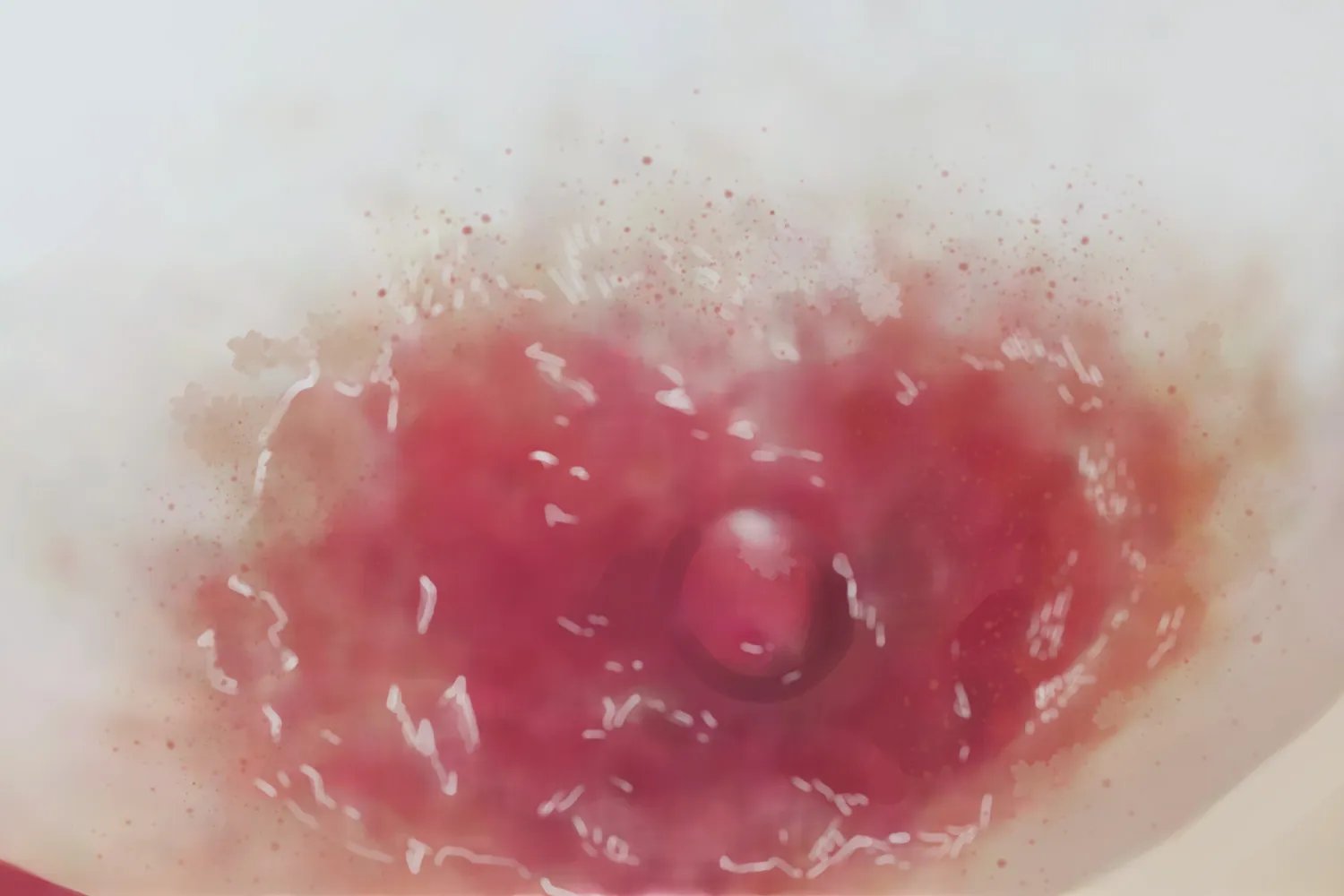 乳房湿疹样癌症状图片