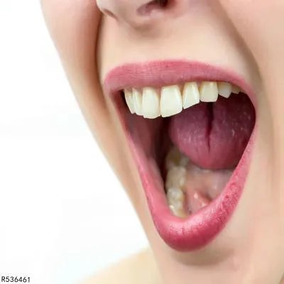 舌苔黄厚是湿热吗 舌苔黄厚的具体原因介绍