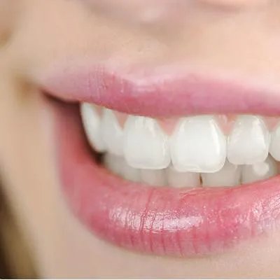 急性智齿冠周炎怎么治疗?