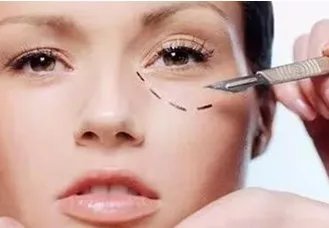 外切眼袋有风险吗?