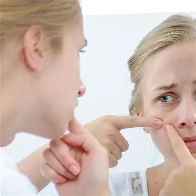 脸上的痘印怎么办