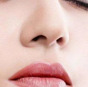 激光去斑要多少钱