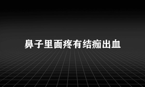 鼻子里面疼有结痂出血