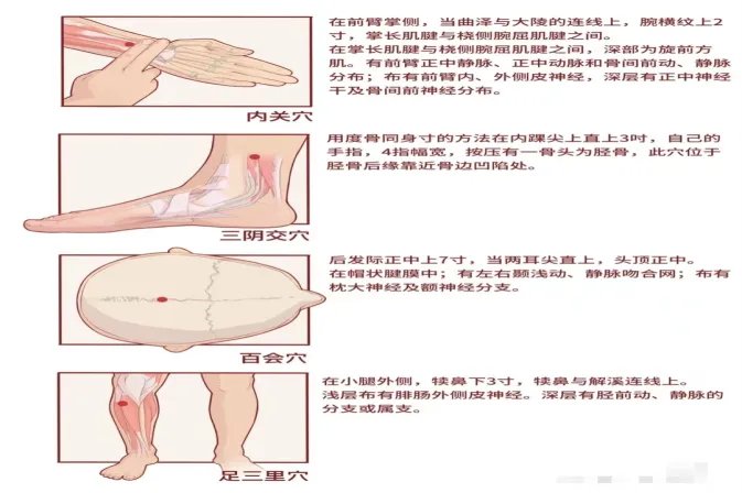 易针疗法示意图