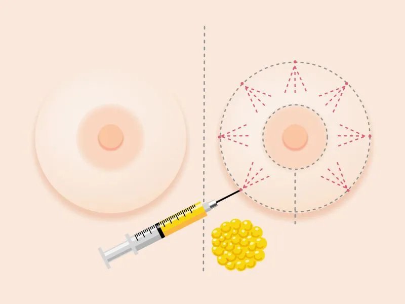 头孢注射液的作用
