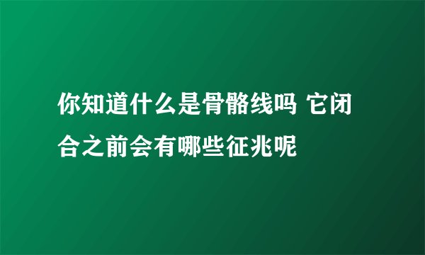 你知道什么是骨骼线吗 它闭合之前会有哪些征兆呢