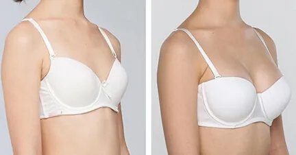 产后如何丰胸啊