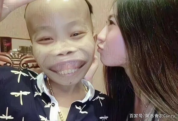 还记得“外星人”陈山吗？被封杀3年之后变化巨大，现在如何了？